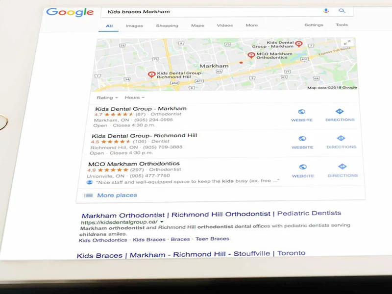 kidsdental-google image